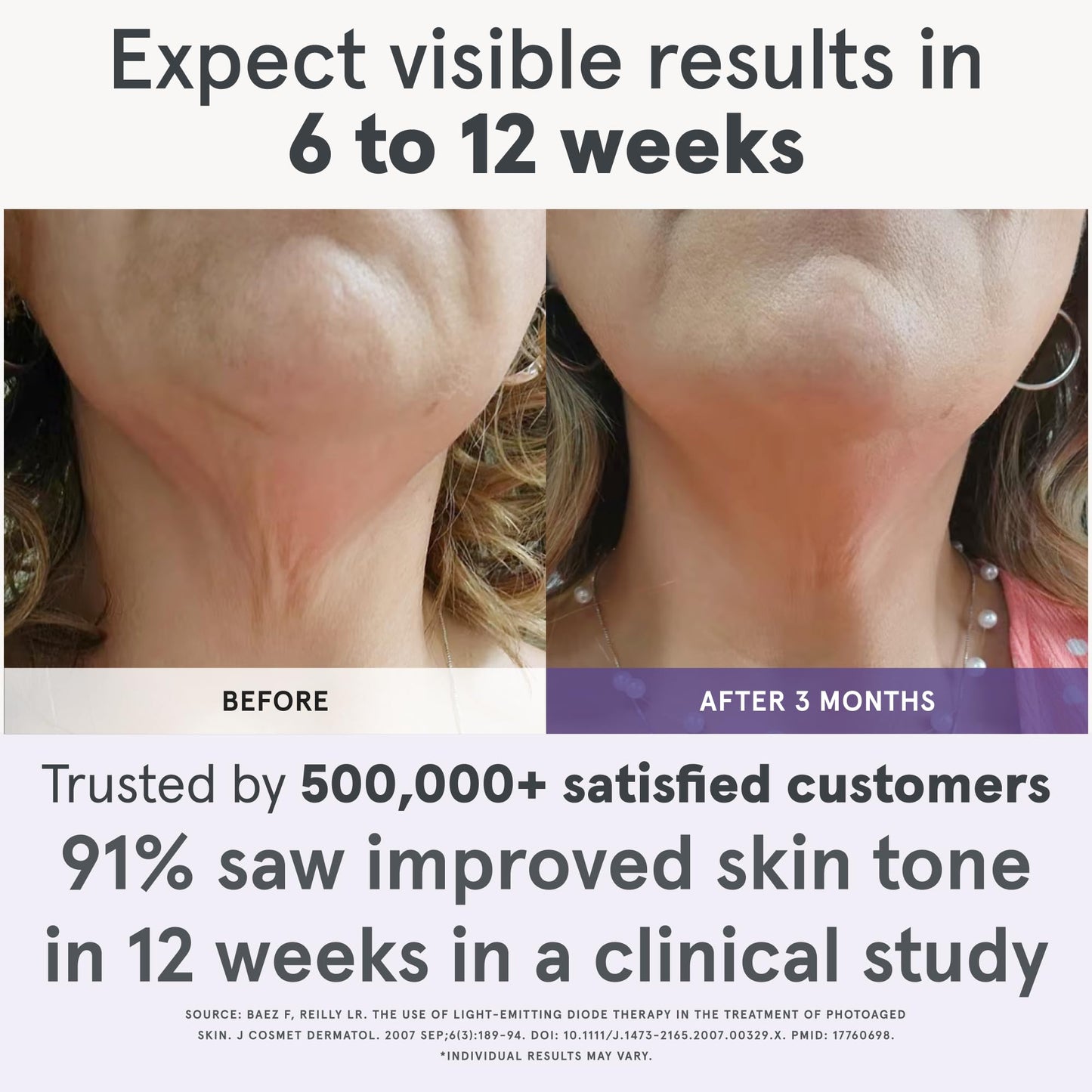 iRestore Illumina LED Neck & Chest Anti Aging Mask – for Smoother, Firmer and Glowing Skin at Home – Red and Infrared Light Therapy for Neck – Red Light Skincare Device with 230 LEDs (White)