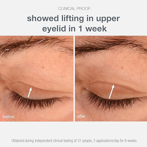 Dermalogica Phyto Nature Lifting Eye Cream, Skin Treatment Serum for Around Eyes - Reduces the Appearance of Fine Lines and Wrinkles