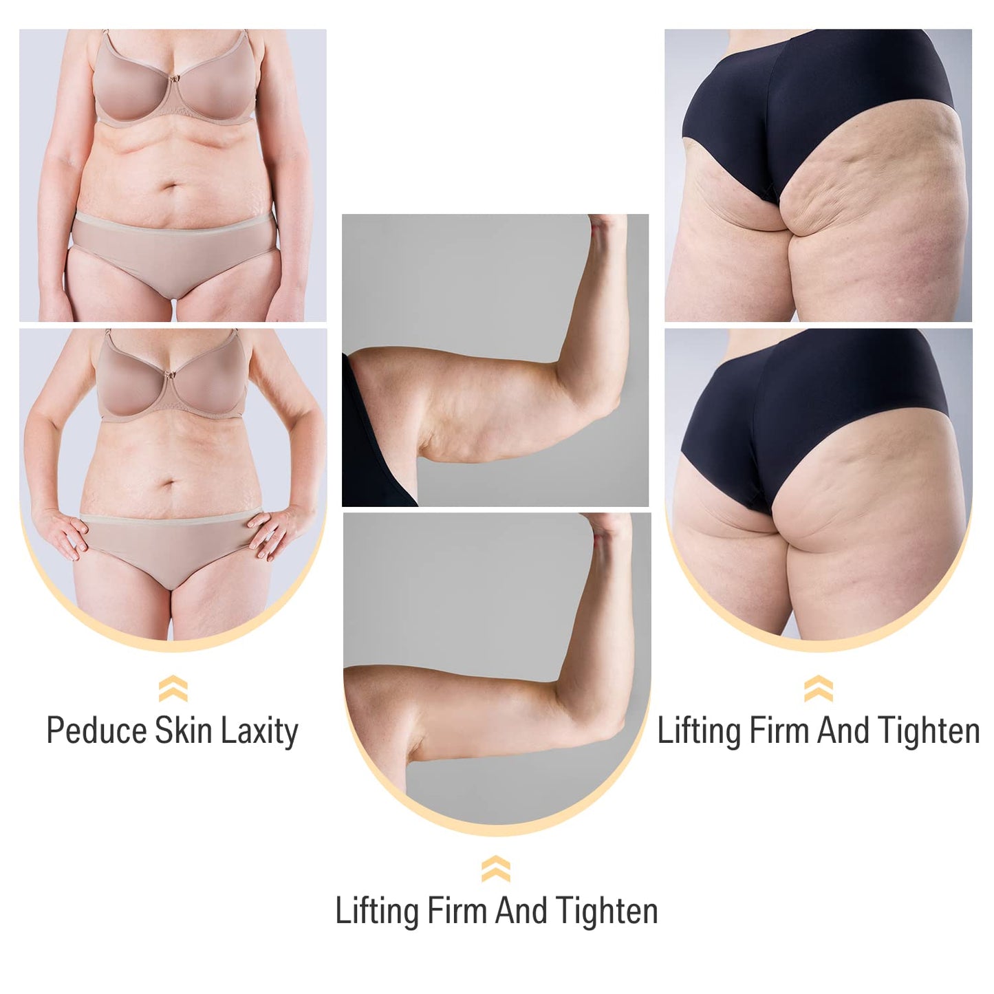 WarmDerm Skin Firming Facial Device, Professional Home Beauty Device for Face and Body, 3 Energy Levels - Salon Results