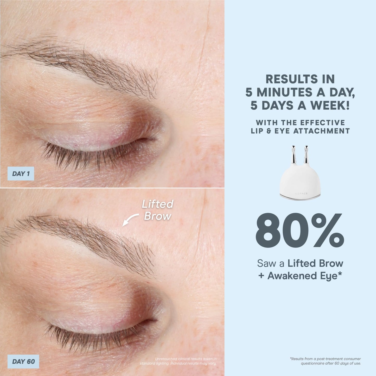 NuFACE TRINITY+ Effective Lip & Eye Attachment for Microcurrent Facial Device - FDA Cleared At Home Eye Lift & Smile Lines Treatment to Tighten & Tone Hard-to-Reach Areas Around Mouth and Eyes