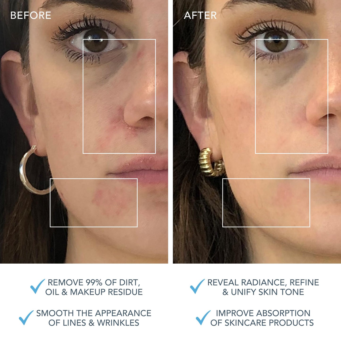 FOREO LUNA 3 Facial Cleansing Brush | Combination skin | Anti Aging Face Massager | Enhances Absorption of Facial Skin Care Products|For Clean&Healthy Face Care|Simple&Easy|Waterproof|Battery Powered