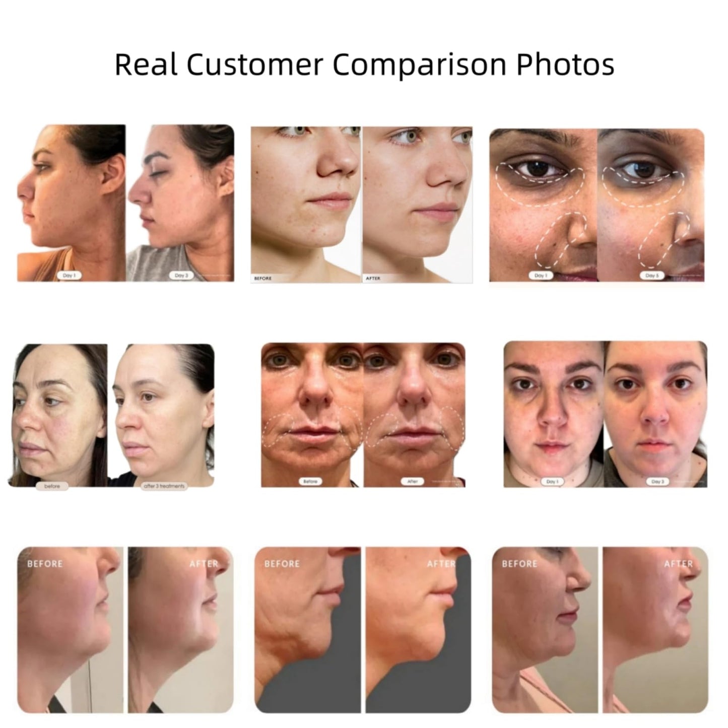 WarmDerm Skin Firming Facial Device, Professional Home Beauty Device for Face and Body, 3 Energy Levels - Salon Results