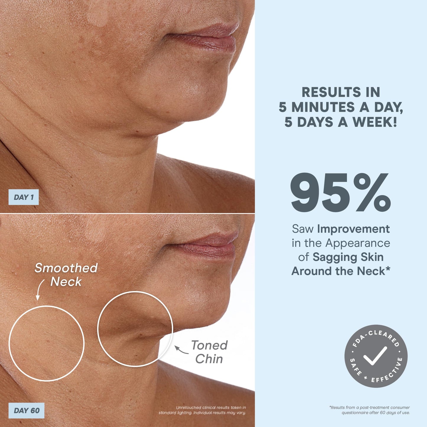 NuFACE MINI+ Microcurrent Facial Device Kit - FDA Cleared Face Sculpting & Skin Tightening Device to Contour, Lift & Tone + Microcurrent Gel Activator & Silk Creme - Violet Dusk